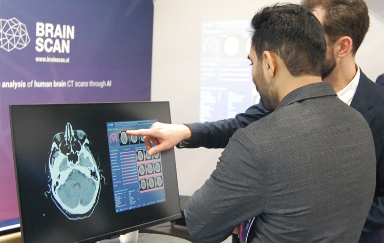 BrainScan, emisja, akcji, strategia, AI