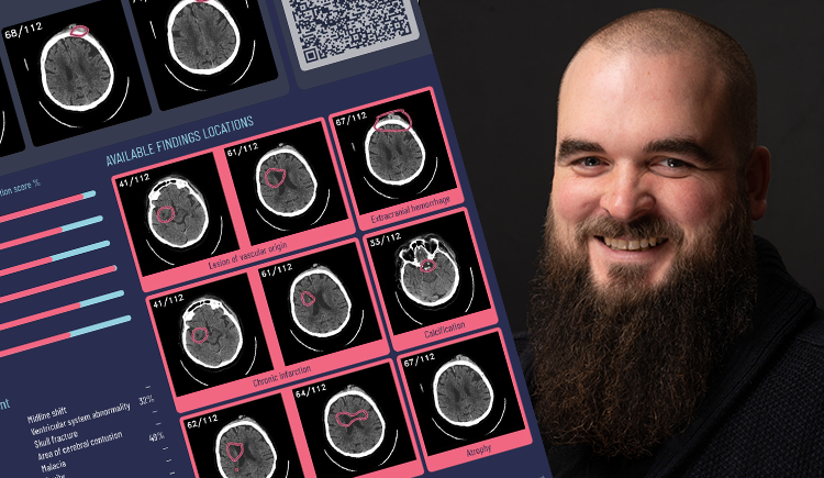 Brainscan, akcje, emisja, akcji, technologie, rynek amerykański