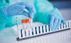 Diagnostyka przejęła dwie spółki z diagnostyki obrazowej za 18,8 mln zł